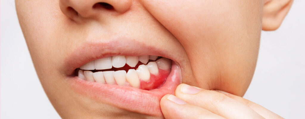 Dental Procedures and Injuries